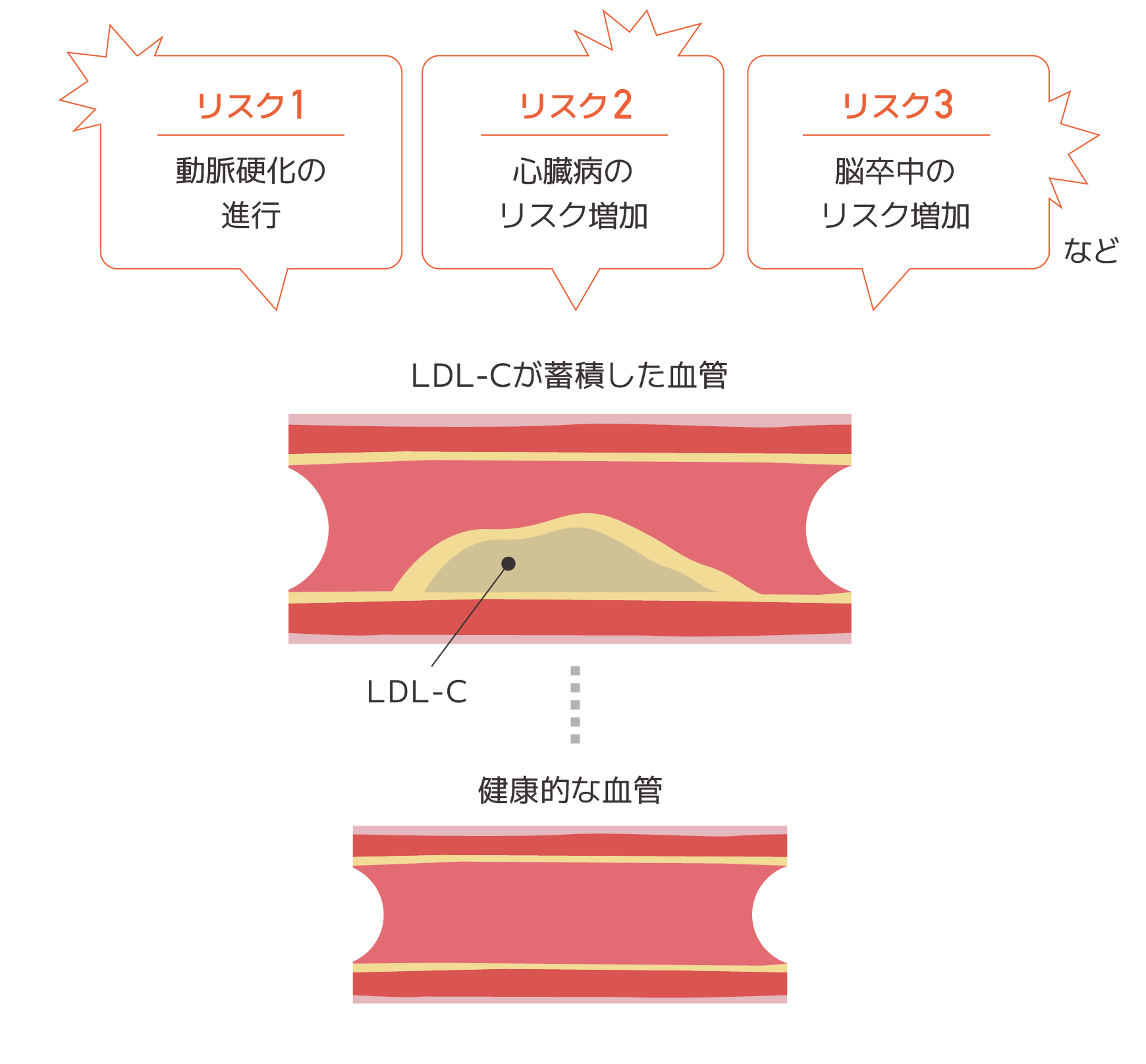 高コレステロールのリスク図 PC用