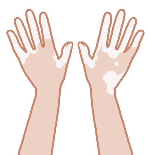 説明文関連イラスト